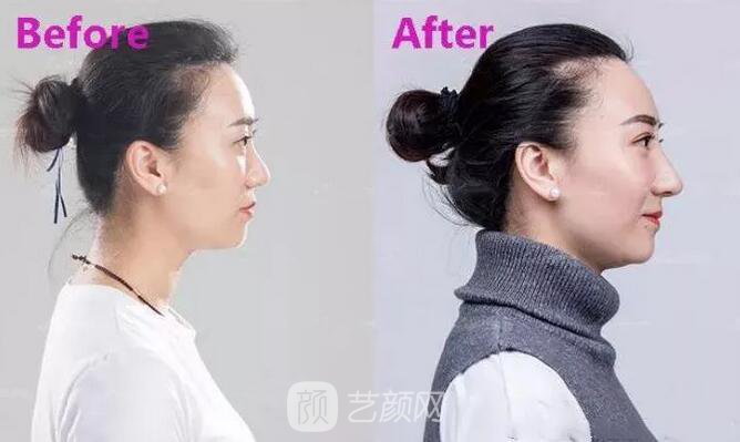 曾經(jīng)被我嘲笑的小眼睛室友，如今變得艷壓群芳？！