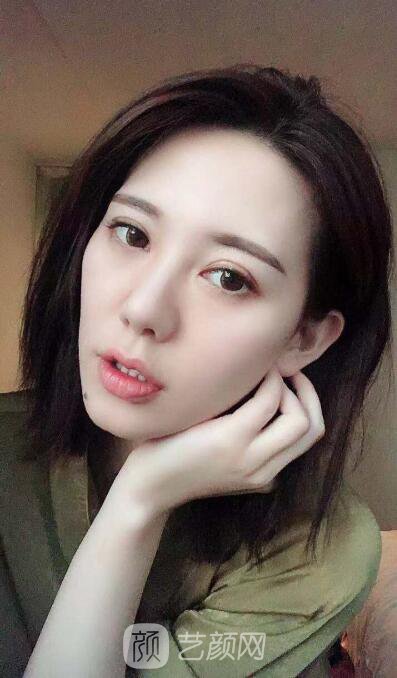 講個超棒超美的案例