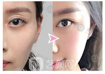 動(dòng)一動(dòng)這些部位，臉顯嫩10倍