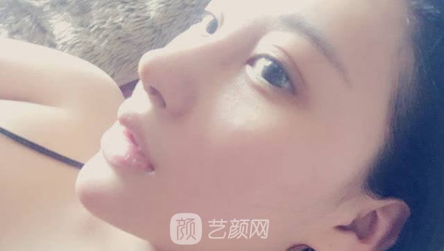 長沙湘雅墊下巴價格多少?