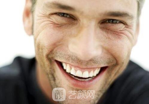 北京整形美容魚尾紋怎么去?