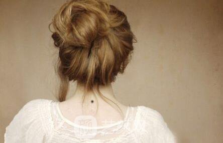 手術去痣價格貴不貴