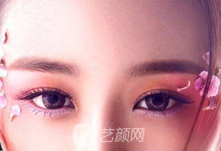 我在四川西區(qū)醫(yī)院整形科做了個(gè)雙眼皮