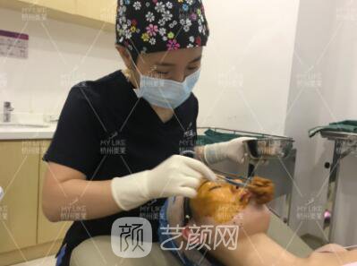 面部下垂怎么改良，埋線提升提升真實案例