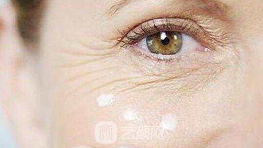 玻尿酸除皺方法方便見快