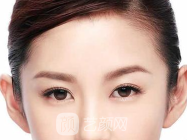 什么是臥蠶整形手術(shù)方法?