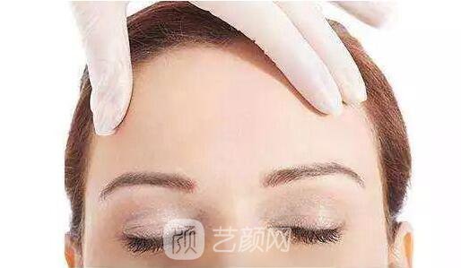 玻尿酸豐額頭護(hù)理方法是什么?