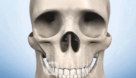 深圳前海聯(lián)合醫(yī)院做的顴骨手術(shù)屌絲變性感妞