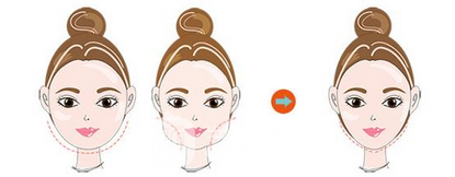 玻尿酸隆鼻+注射瘦臉讓你一目了然