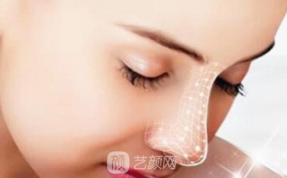 隆鼻果出來(lái)了朋友們都說(shuō)好