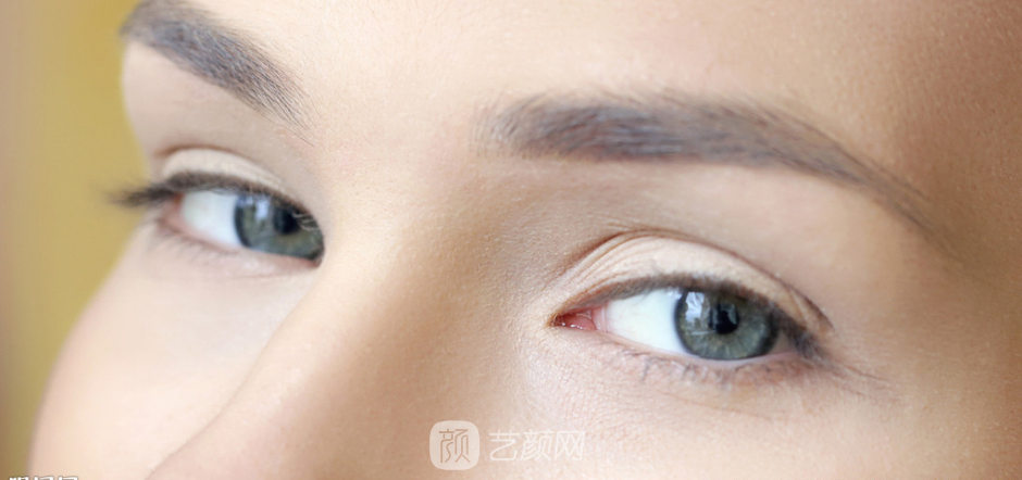 雙眼皮要怎么割，才能別人才看不出來