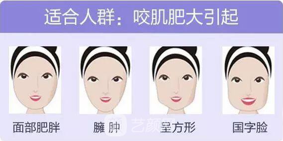 西安畫美醫(yī)療美容醫(yī)院的注射瘦臉多少錢?