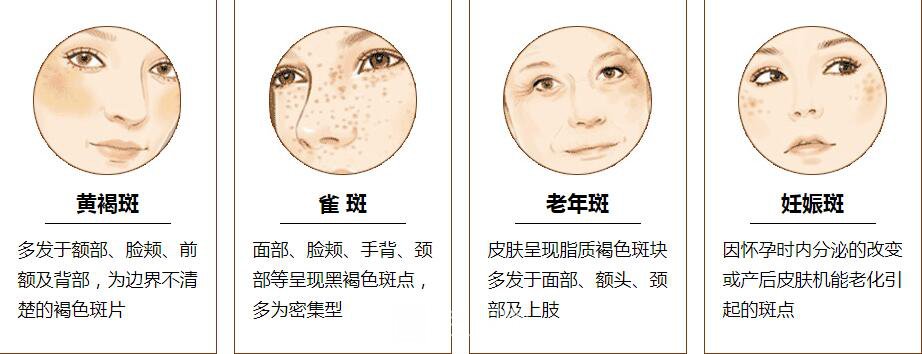 調(diào)節(jié)黃褐斑是長期的工程，需要堅(jiān)持才能見果