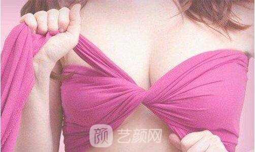 自體脂肪隆胸常見十大問題 科學(xué)解開隆胸的顧慮