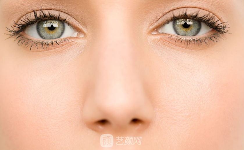 做了眼部+鼻部整形手術(shù)讓我從丑小鴨變成白天鵝