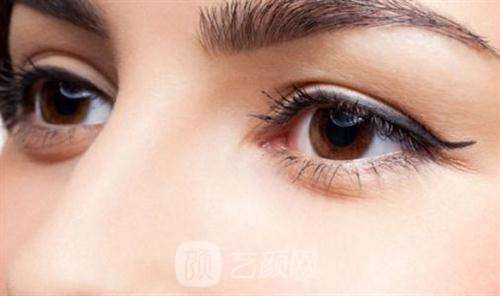 雙眼皮術(shù)后，必須經(jīng)歷的五個階段?