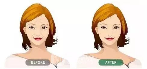 熱瑪吉除皺美眼的價(jià)格是多少錢