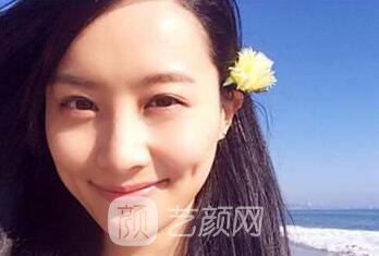 如果是你去做隆鼻 你想要網(wǎng)紅鼻還是個(gè)性鼻?