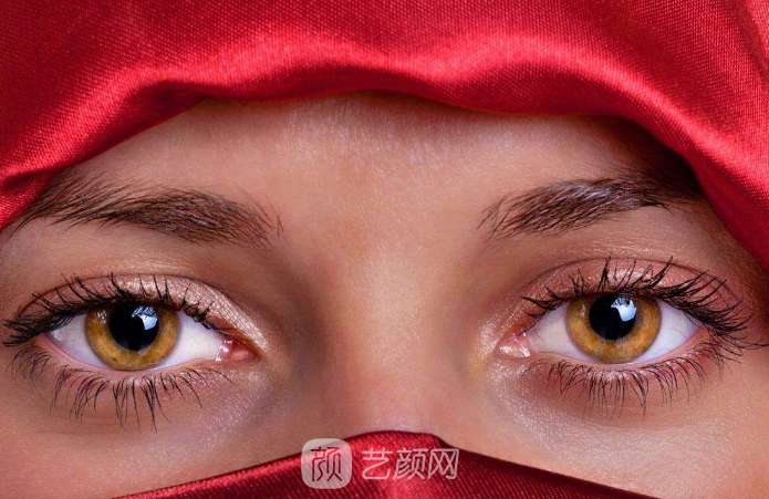 雙眼皮案例：從窄雙眼皮到寬雙眼皮——美，沒有界限。
