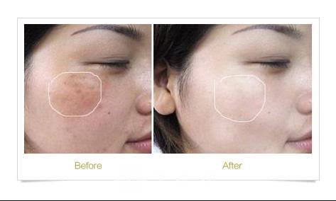 廣州曙光美容醫(yī)院疤痕專家怎樣