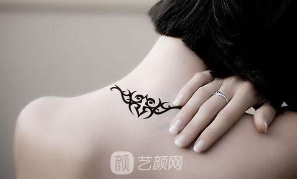 哈密哪里有去除紋身的地方