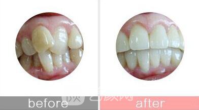 衡陽市牙齒整形選哪家醫(yī)院好