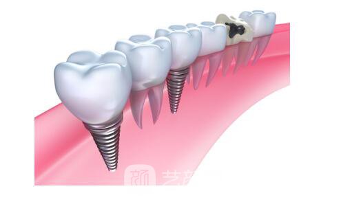 衡陽市牙齒整形選哪家醫(yī)院好