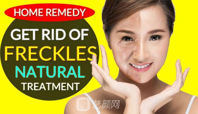 湖南激光祛斑好嗎？