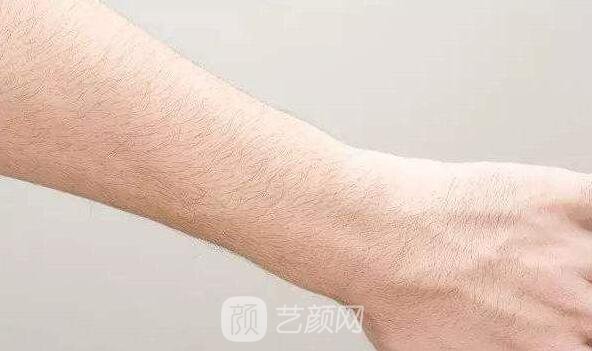 成都地區(qū)激光脫毛的價(jià)格是多少？