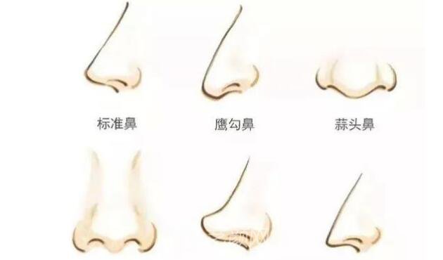 綿陽(yáng)微晶石隆鼻多少錢