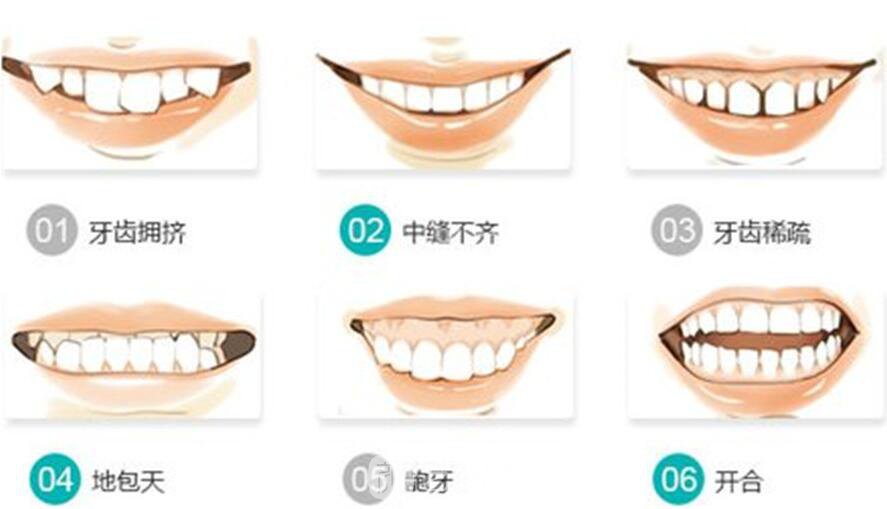 如何阻止地包天的發(fā)生，專業(yè)醫(yī)生為你解答