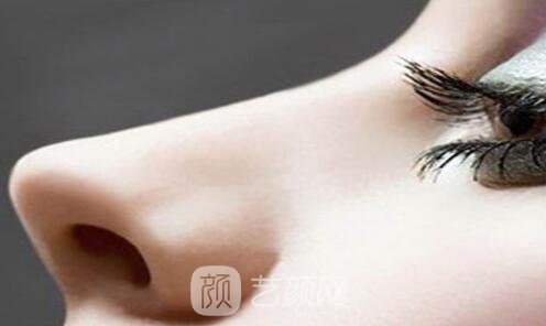 2019全新發(fā)布玻尿酸隆鼻手術(shù)價(jià)格