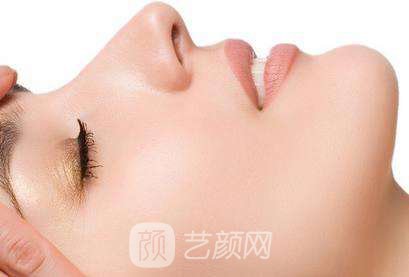 隆鼻案例：隆鼻+雙眼皮+下巴已經(jīng)不是原來(lái)自卑的我了~