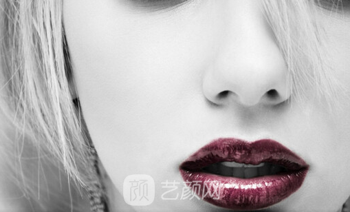 隆鼻果出來了朋友們都說好，大家如何看呢？