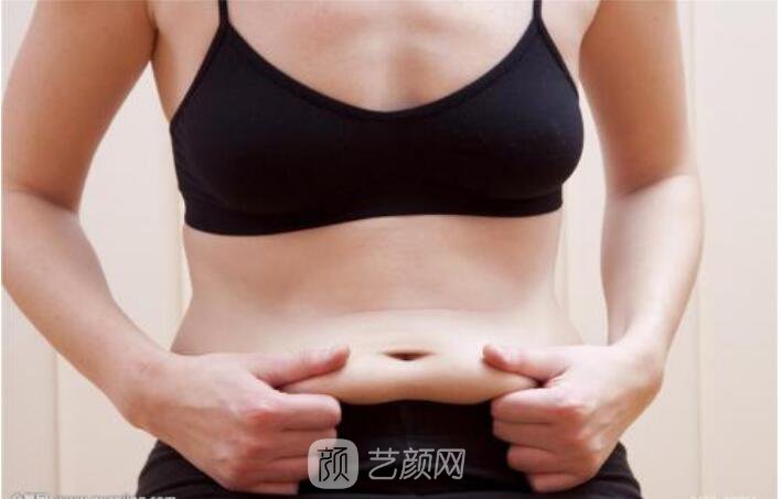 新媽媽分享吸脂經(jīng)歷!朋友都說我沒生過娃