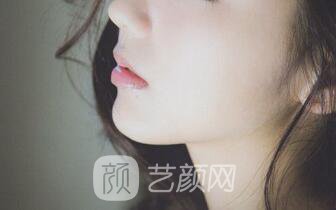 玻尿酸隆鼻+下巴之后，仿如新生，走上人生尖峰