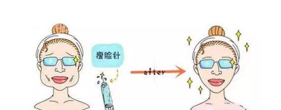 打注射瘦臉后臉真變小了，看來(lái)注射瘦臉真如傳聞所言