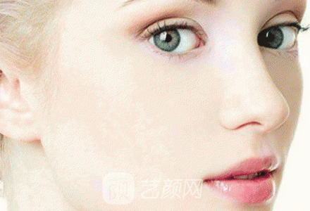 分享水光嫩膚親身體驗(yàn)感受，變美就是這么簡(jiǎn)單