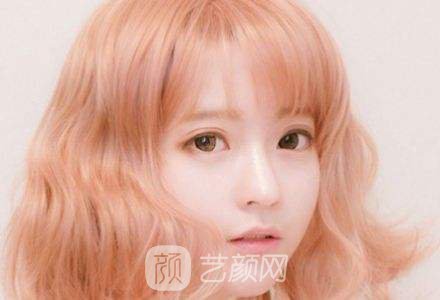 韓式三點(diǎn)翹睫雙眼皮恢復(fù)過程心里美美噠