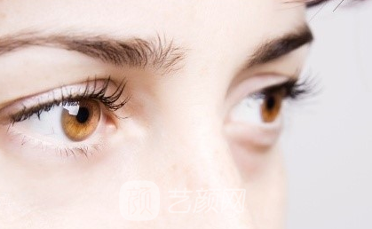 如何讓眼睛更美麗的雙眼皮手術(shù)？