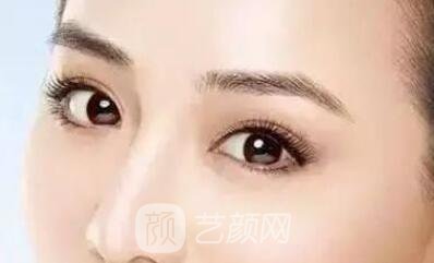 埋線雙眼皮的果不是******的？