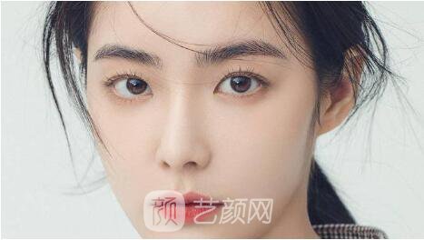 雙眼皮整形沒問題嗎？