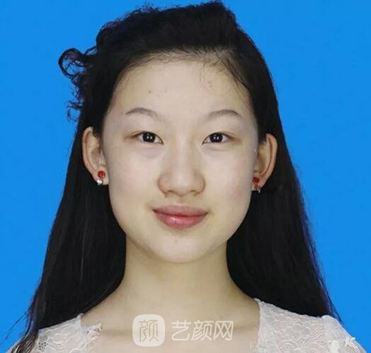 鄭裕錫歐巴駕到：扇形&平行如何選？