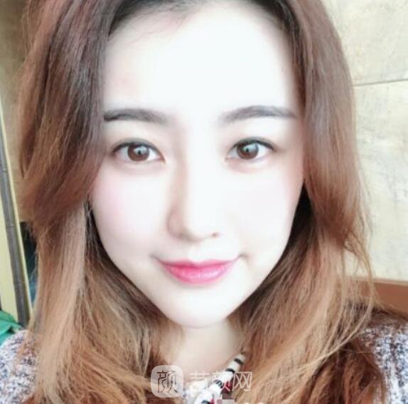 總體消化吸收的十分較為好，看上去看起來自身更年輕