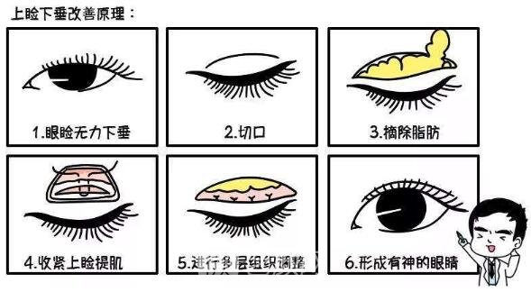  【眼部手術(shù)手術(shù)】九院眼部手術(shù)手術(shù)哪位醫(yī)生做的好？