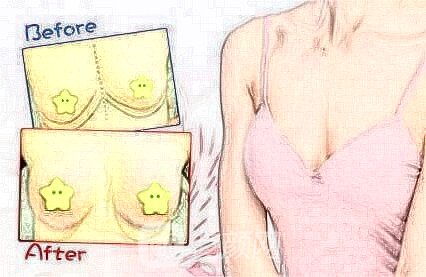 復合型豐胸手術(shù)的優(yōu)勢有什么?