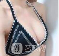 價錢要看胸部的不成功狀況