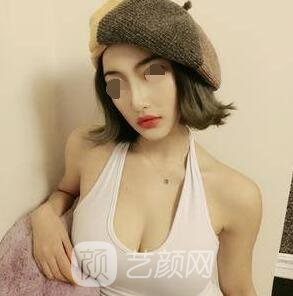 影響隆胸價(jià)格的要素有什么?