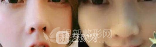 斗魚第一女主播馮提莫的進化史：從素人到網(wǎng)紅！