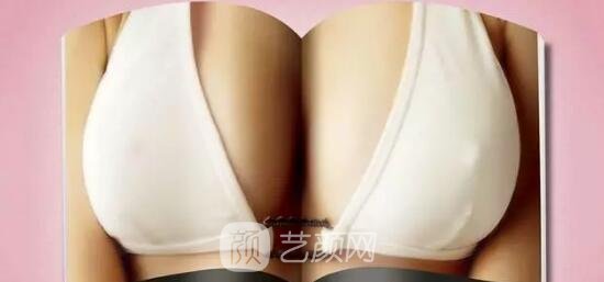 那些給隆胸扣的冤枉帽子！